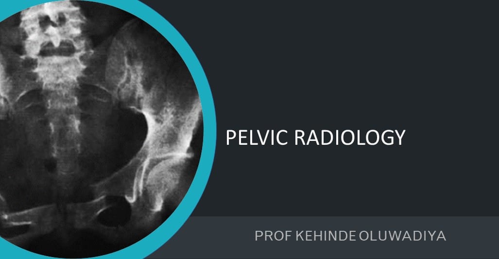 Pelvic radiology
